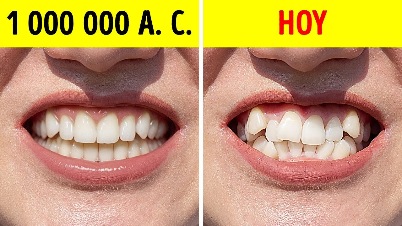 Por qué los humanos primitivos tenían dientes perfectamente rectos