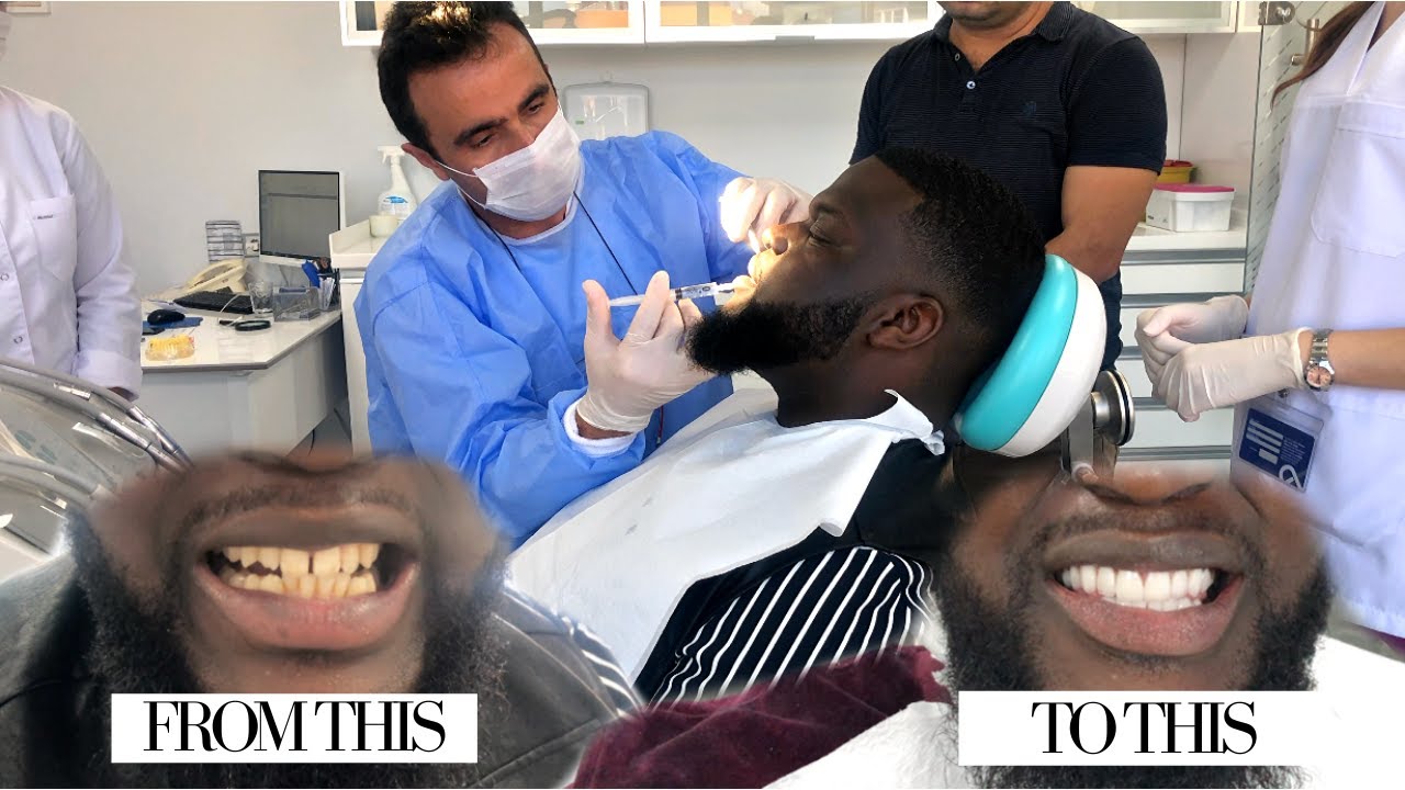 AFTER THE PROPOSAL WE WENT STRAIGHT TO TURKEY, AGAIN... & BEN GOT HIS TEETH DONE! 👀😆| #BeingNissyTee