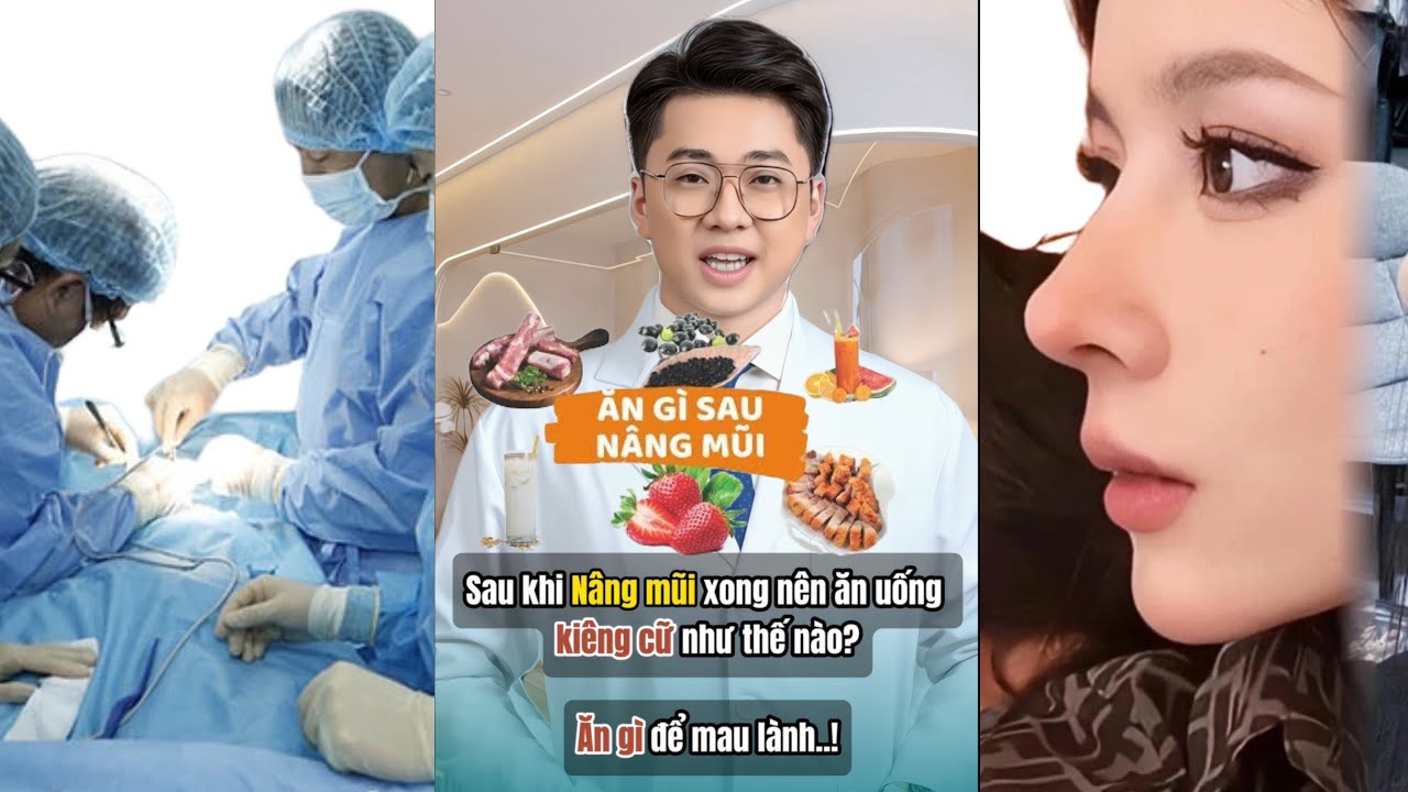N&acirc;ng mũi xong ăn uống như thế n&agrave;o v&agrave; cần ki&ecirc;ng cữ những điều g&igrave; ? #nangmui #kienthucnangmui #pttm