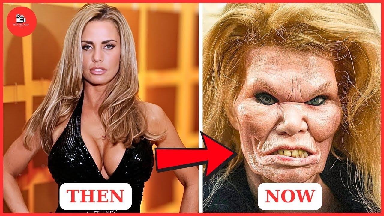 LIVE:33 Black Celebrities Who Secretly Had Plastic Surgery You Didn’t Know About | Then and Now 2026