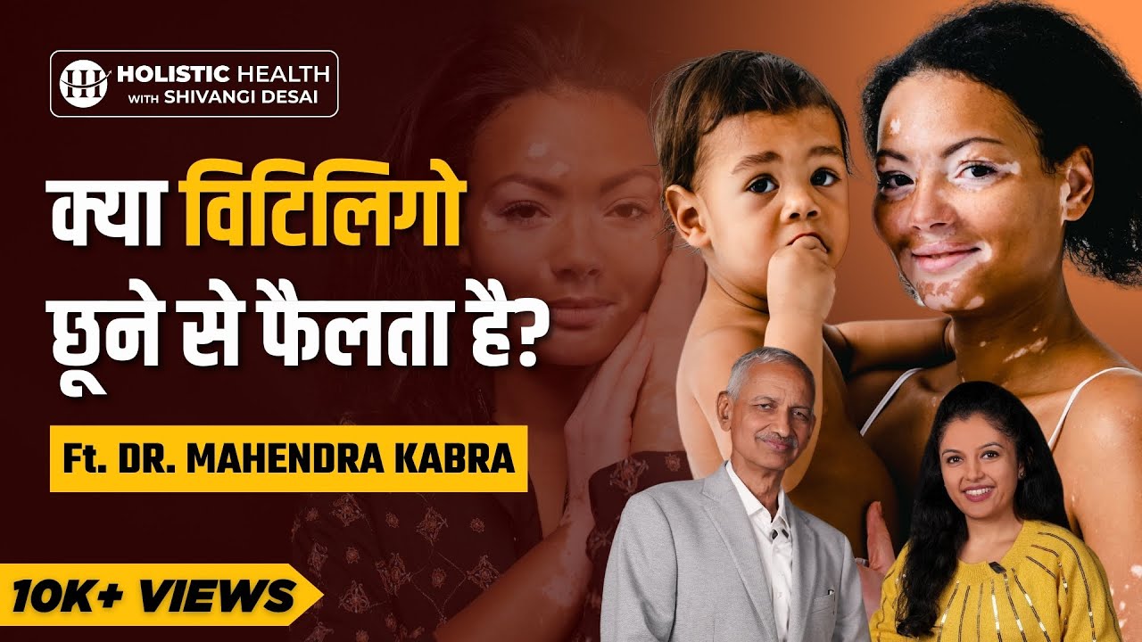 Breaking Myths About Vitiligo: Causes, Types, and Treatment! | Shivangi Desai