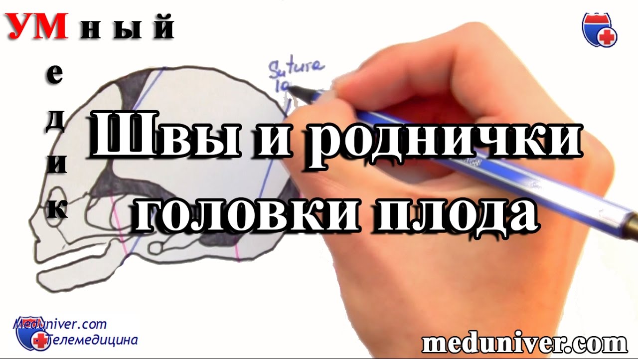 Швы и роднички плода. Плод как объект родов - meduniver.com