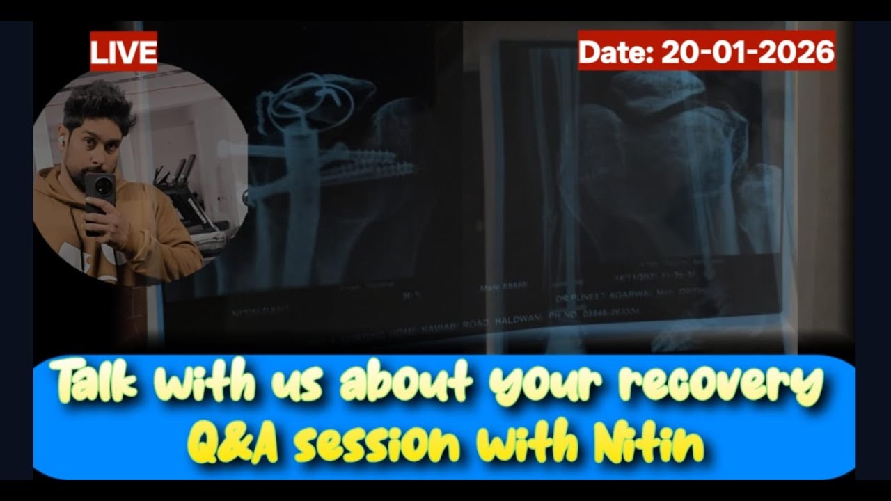 LIVE Q&A #20-2026: Tibia/Femur Fracture– Bone Healing Knee Bending Recovery Tips @SurvivalWithNitin