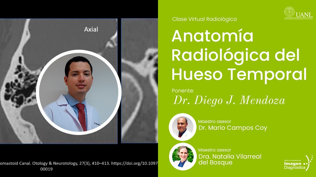 Anatomía Radiológica del Hueso Temporal