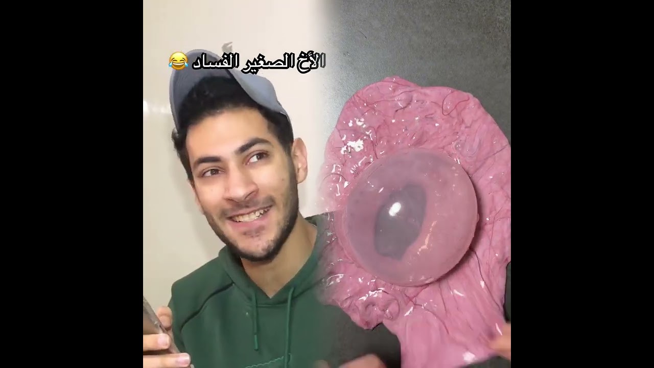 🤣👌👌👌2025 pov Must-Watch Crazy Clips Compilation #humor #fypシ #pov #fyp #foryou 😍😜