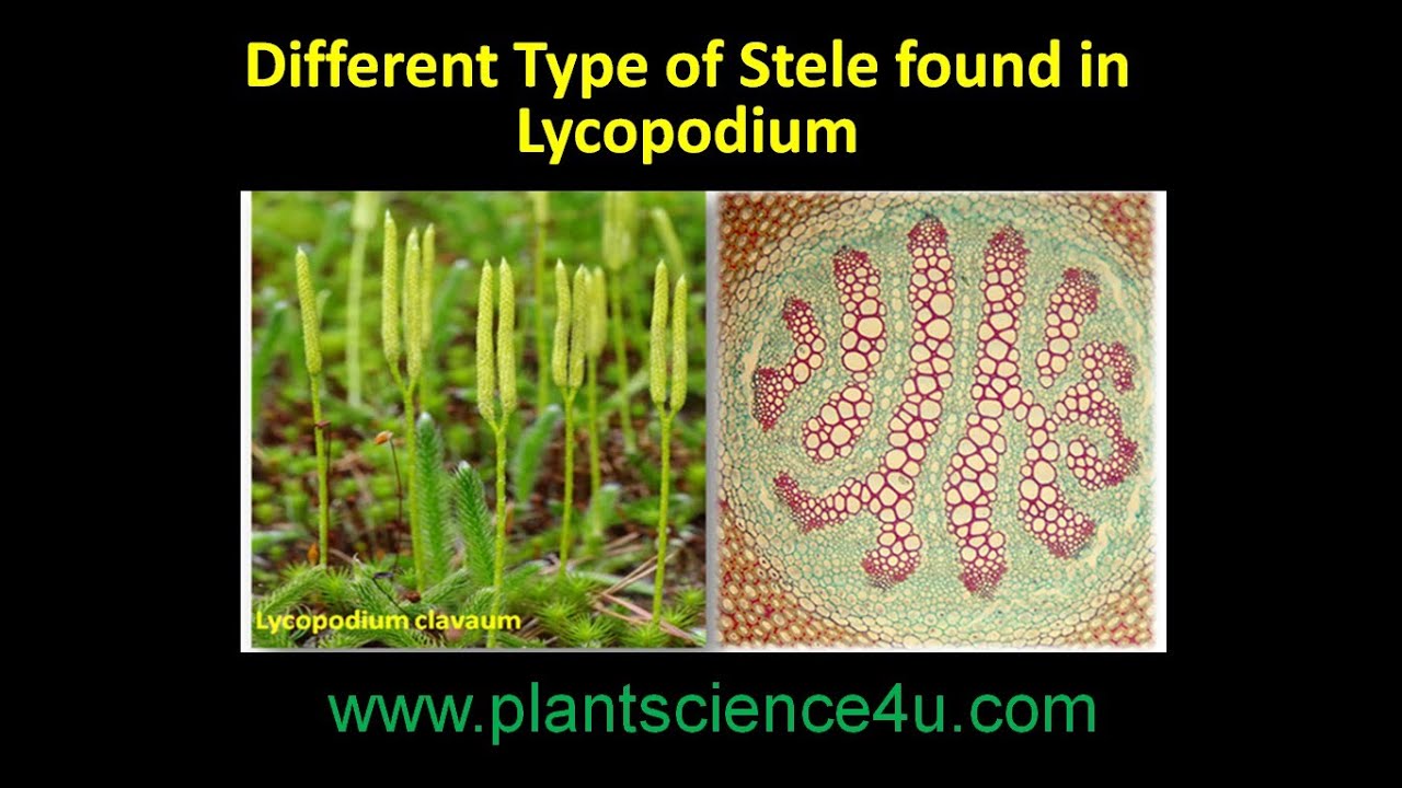 Different types of Steles found in Lycopodium