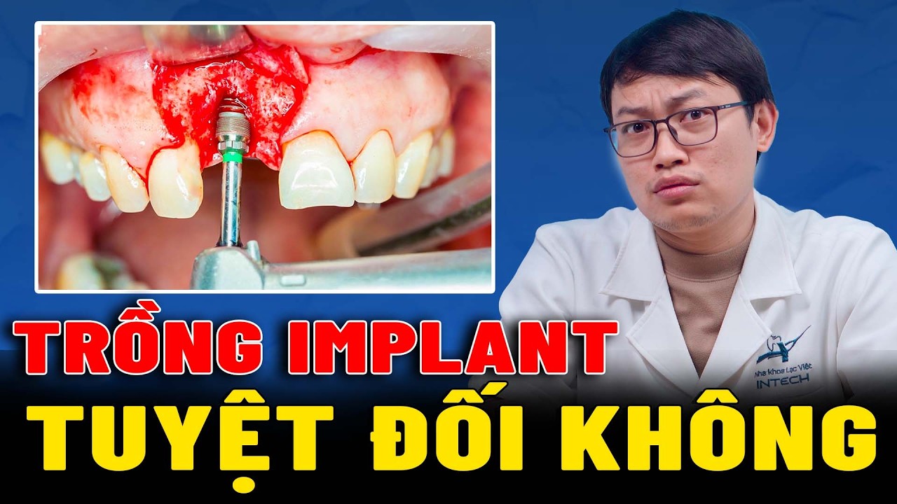 Đừng làm implant, hãy làm cách này” – Ghép xương? Tuyệt đối đừng làm | Bác sĩ chia sẻ sự thật
