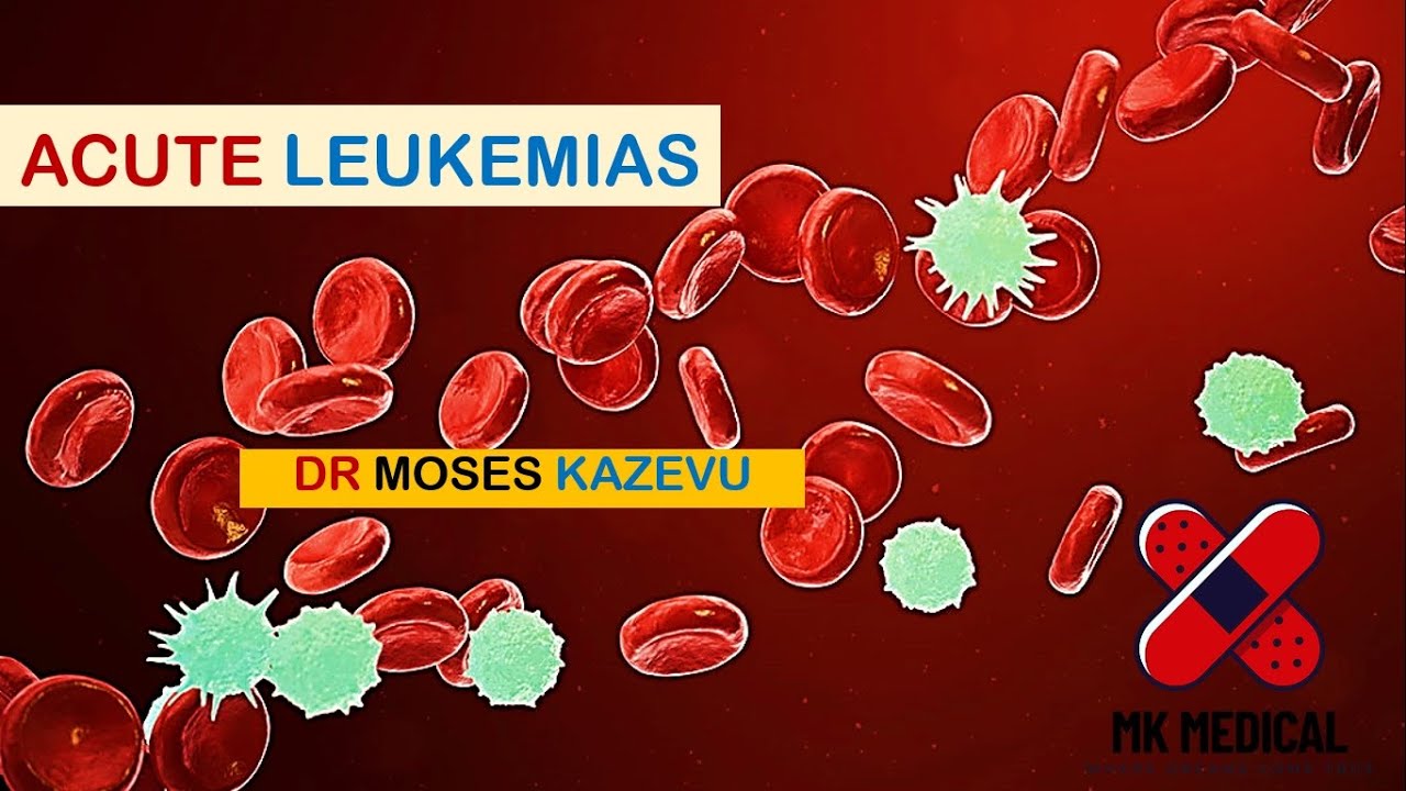 Acute Leukemias