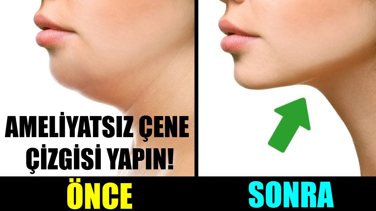 GÜZEL BİR ÇENE ÇİZGİSİNE AMELİYATSIZ KAVUŞUN!