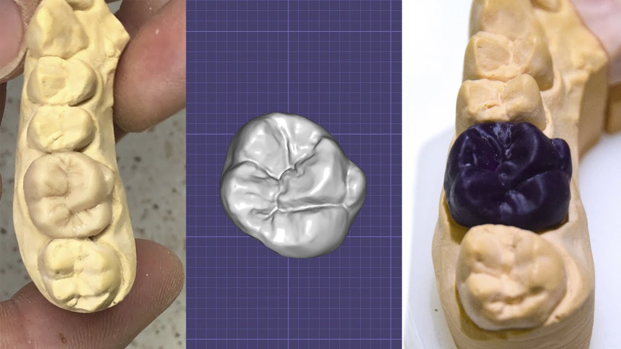 Wax-up или зачем нужна цифра