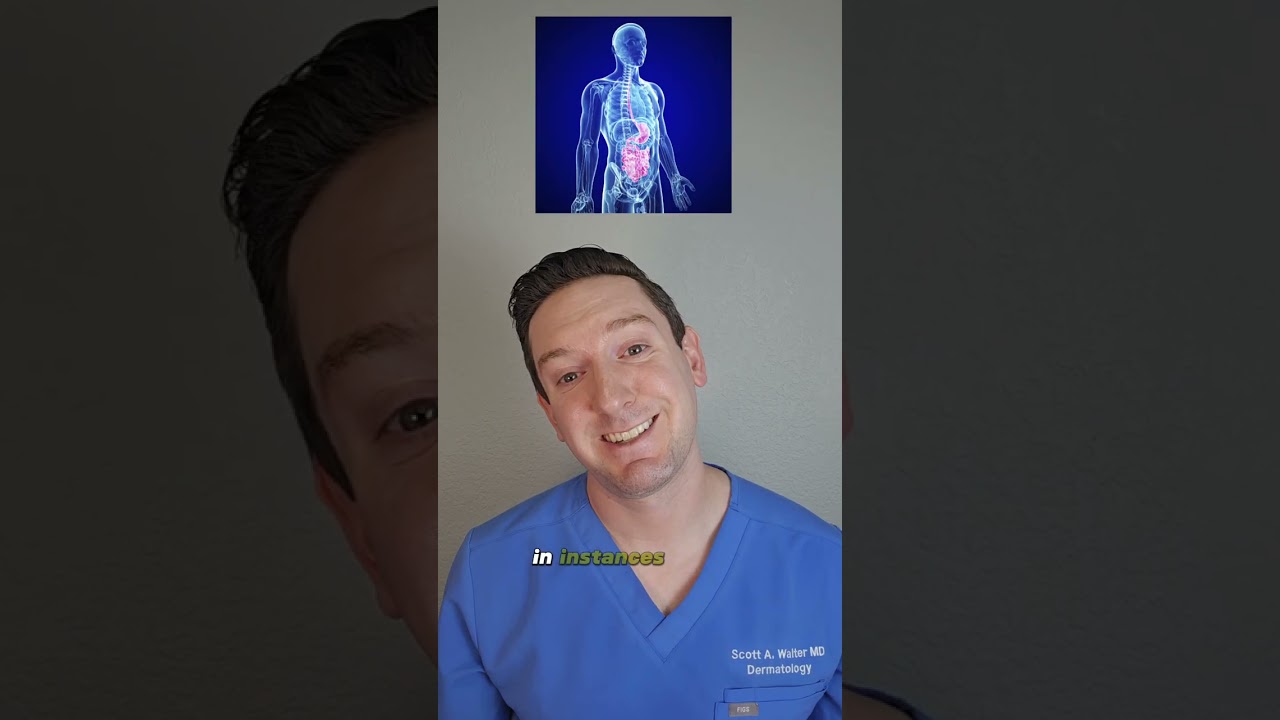 Dermatologist explains Acanthosis Nigricans: Dark patches on neck