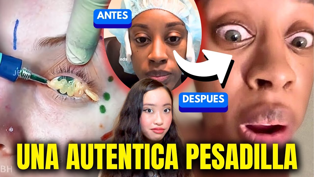 Cambia el color de tus ojos con una cirugía | LA PELIGROSA NUEVA TENDENCIA ESTÉTICA