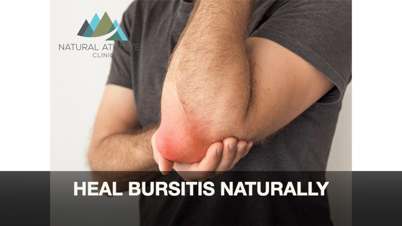 Heal Bursitis Naturally