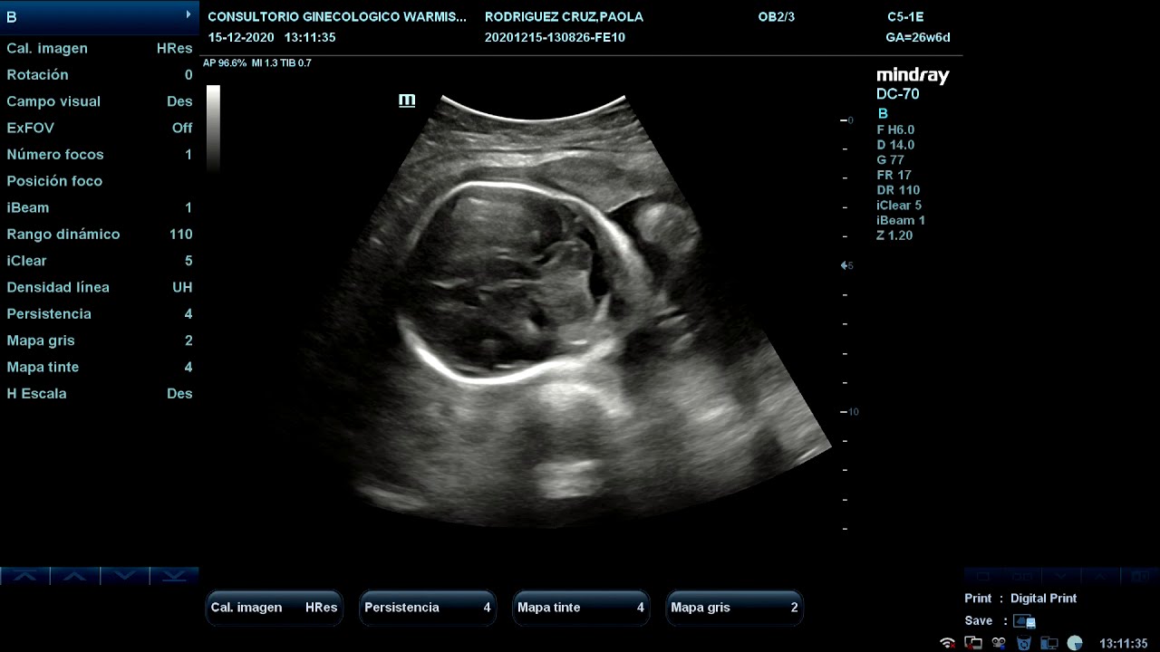 Ecografia Obstetrica