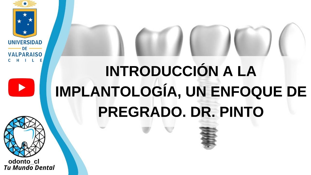 Introducci&oacute;n a la implantolog&iacute;a, Un enfoque de pregrado. Dr. Pinto