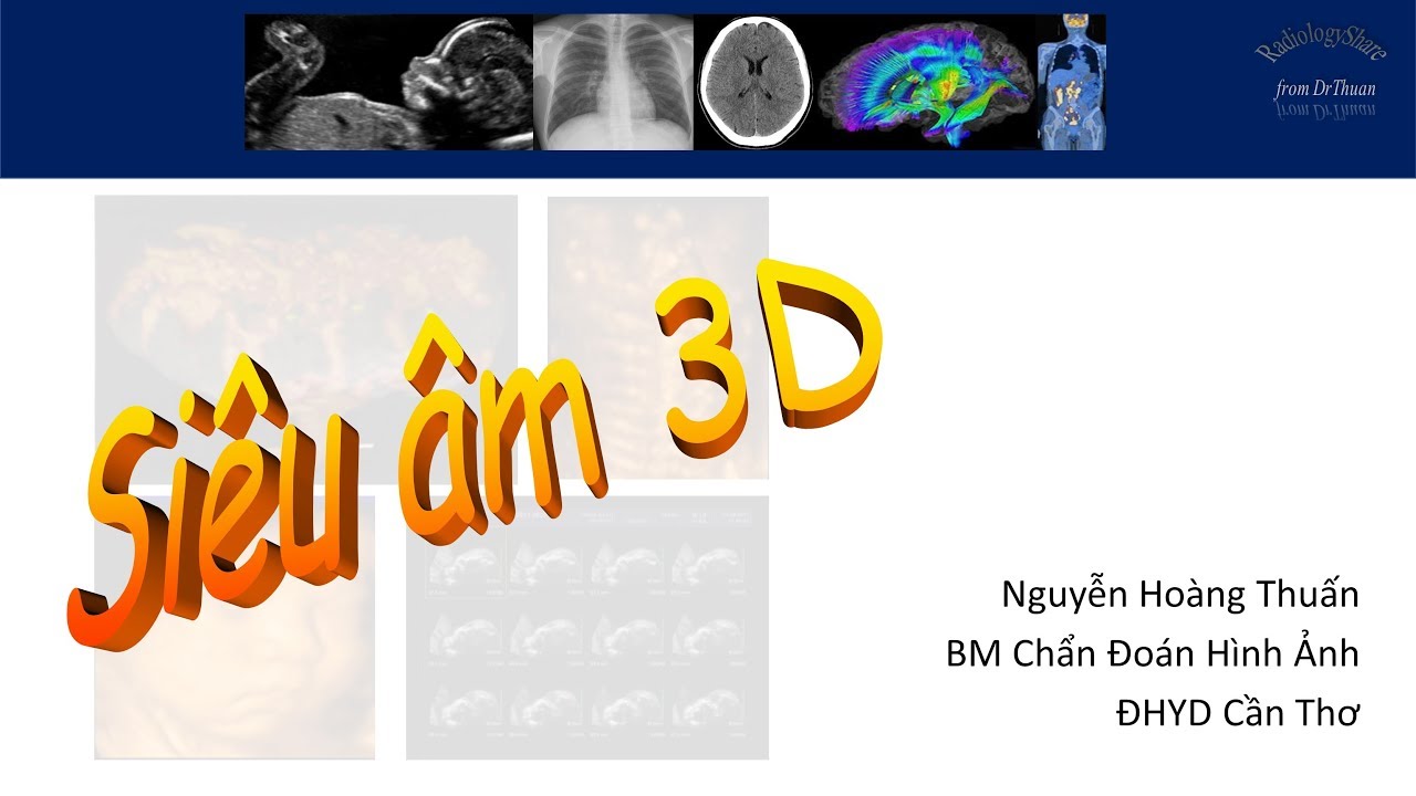 Siêu âm 3D phần 2