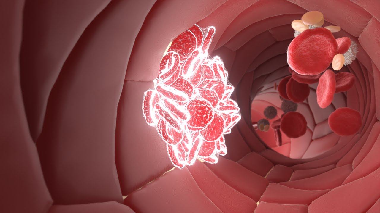 So gerinnt dein Blut  | Animation