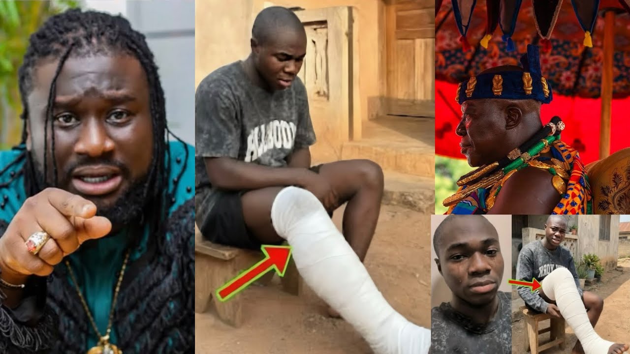 Young Don in Serious Trouble After Insulting Otumfuo, Ajagurajah & Chief Imam 😱 His Leg Now Rotting