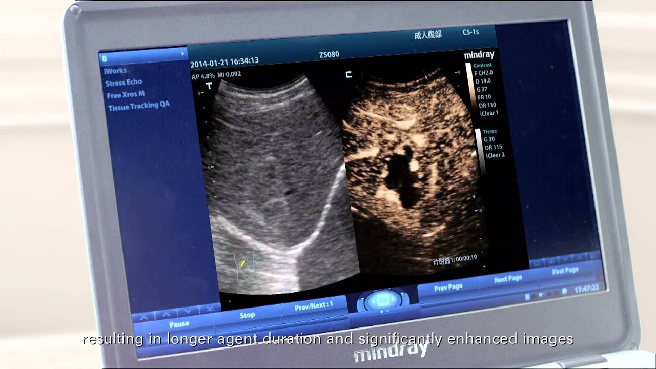 M9 Ultrasound System - the device
