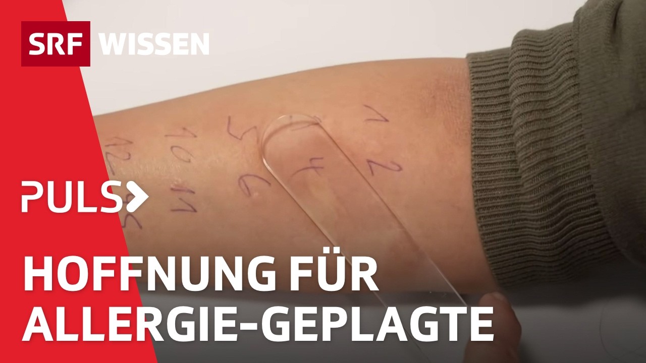 Neue Hoffnung bei Allergien – Was bringen Bluttest, Immuntherapie oder Hypnose? | Puls | SRF Wissen