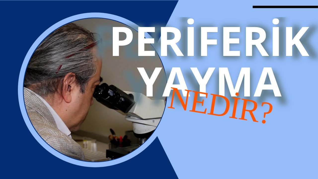 Periferik Yayma Nedir?