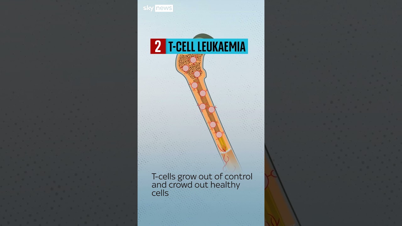 Breakthrough in treating 'incurable' blood cancer