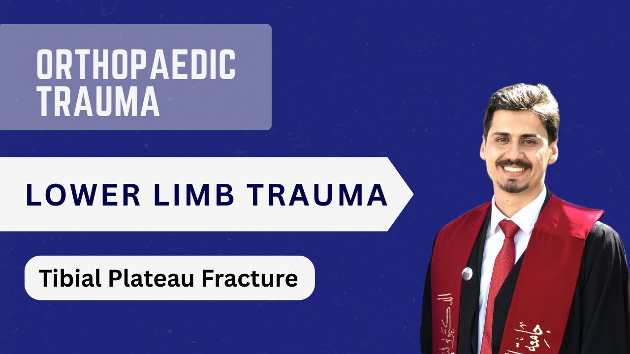 Tibial Plateau Fracture شرح 