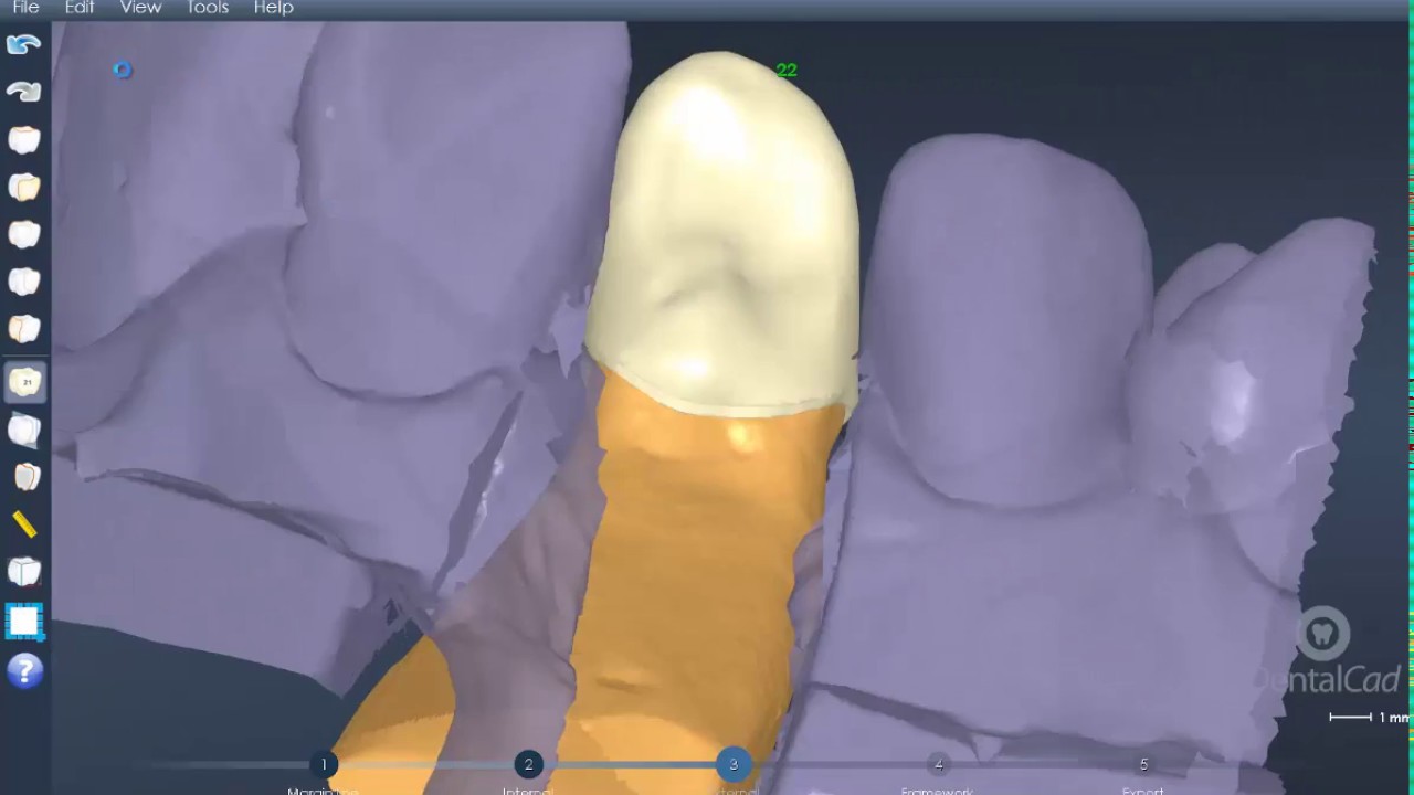 DentalCad 5.4 &ndash; Tutorial &ndash; Acquisition and modeling tools &ndash; Single Crown