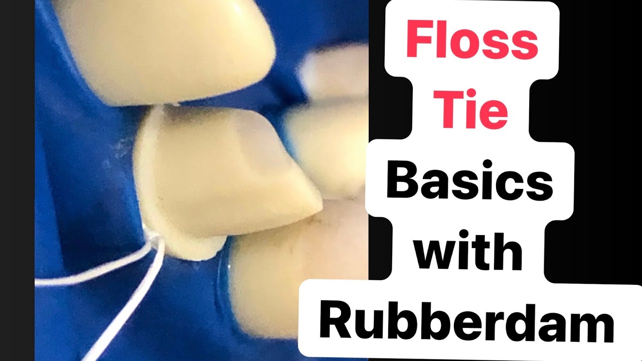 FLOSS LIGATURE BASICS  (FLOSS TIE)