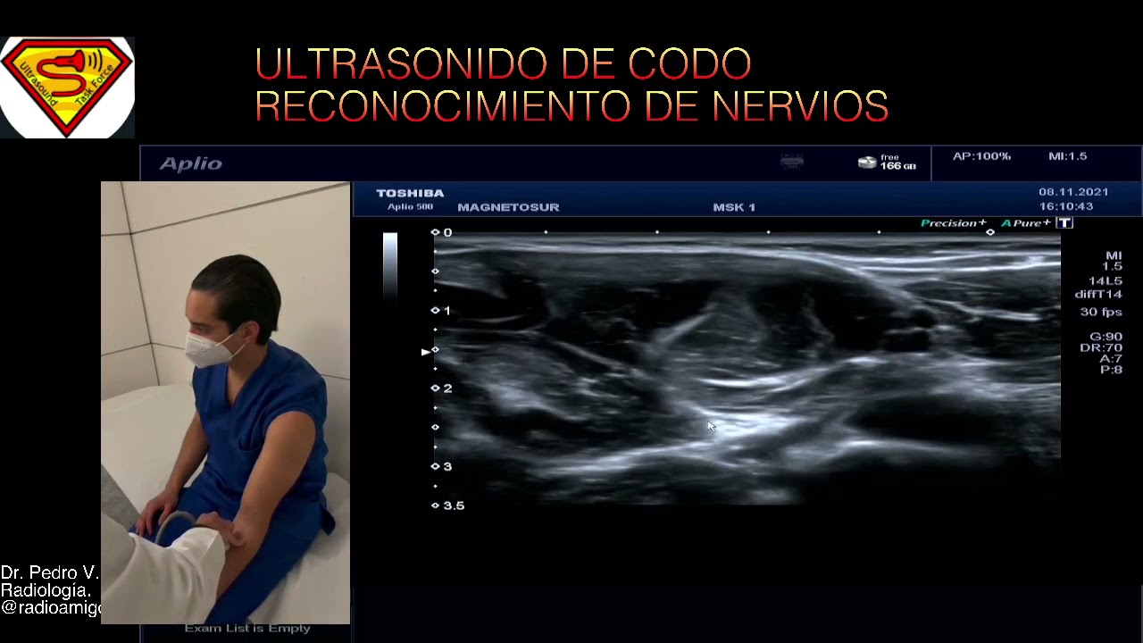 NERVIOS A NIVEL DEL CODO - RECONOCIMIENTO ECOGRÁFICO