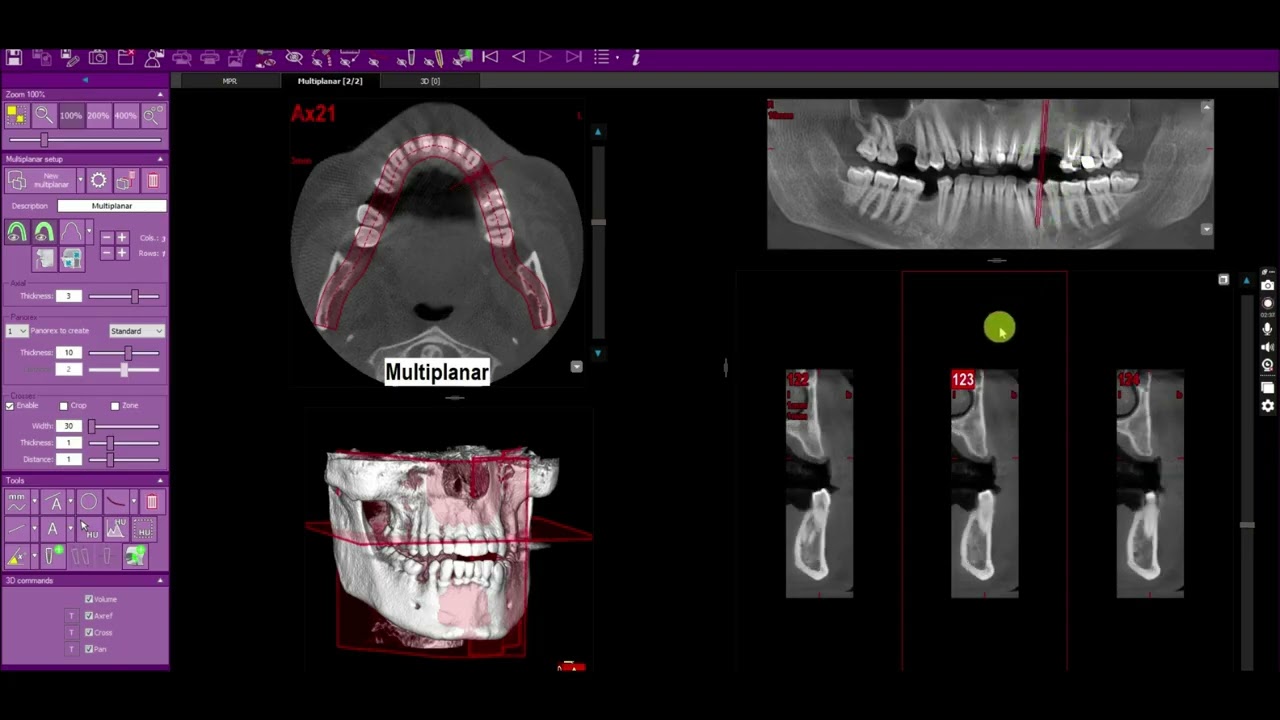 CBCT in endodontics - full version