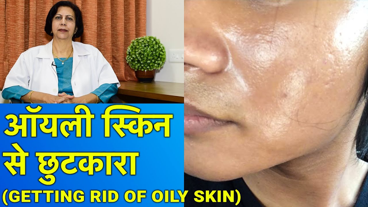 ऑयली स्किन से छुटकारा || Treatment of Oily Skin (In HINDI)