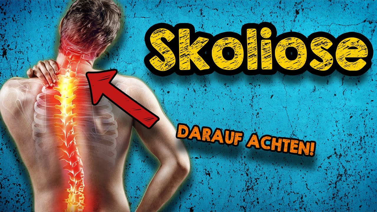 Skoliose Therapie: Warum wird dieser Weg so oft übersehen? Muskeltraining statt OP