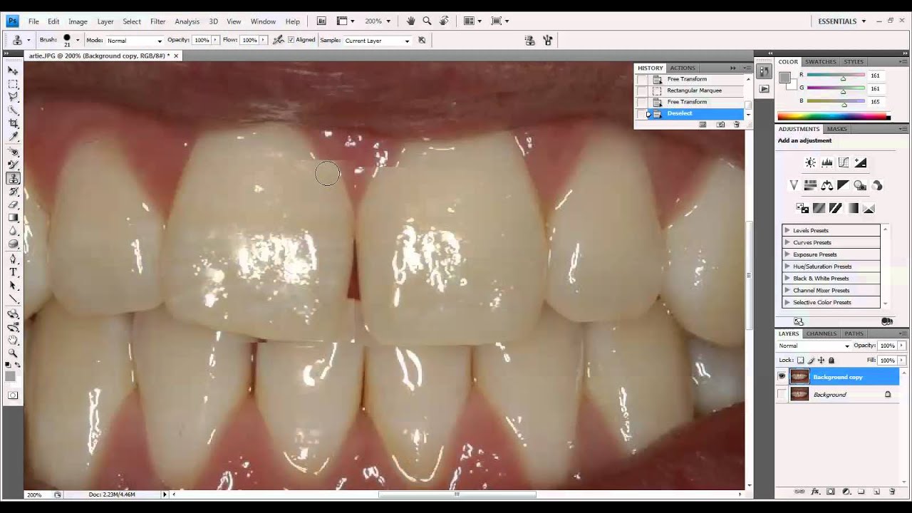 Photoshop Diastema Closure