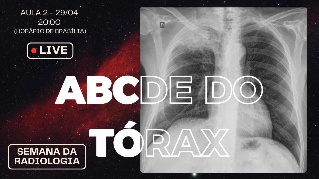 ABCDE do Tórax
