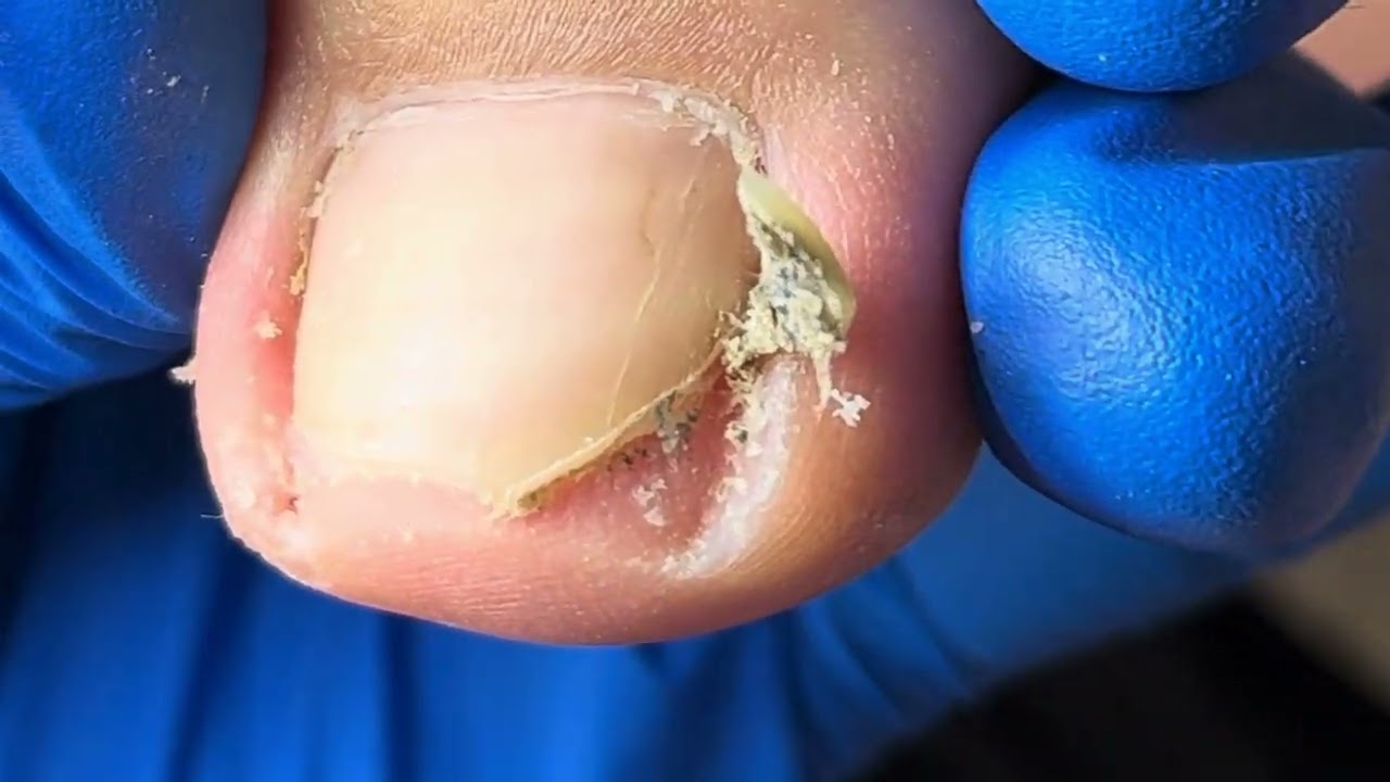 Curly ingrown armor hides a lot of dirt!【Xue Yidao】