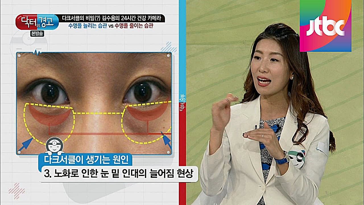 건강의 적신호, 다크서클이 생기는 이유는? 닥터의 승부 149회