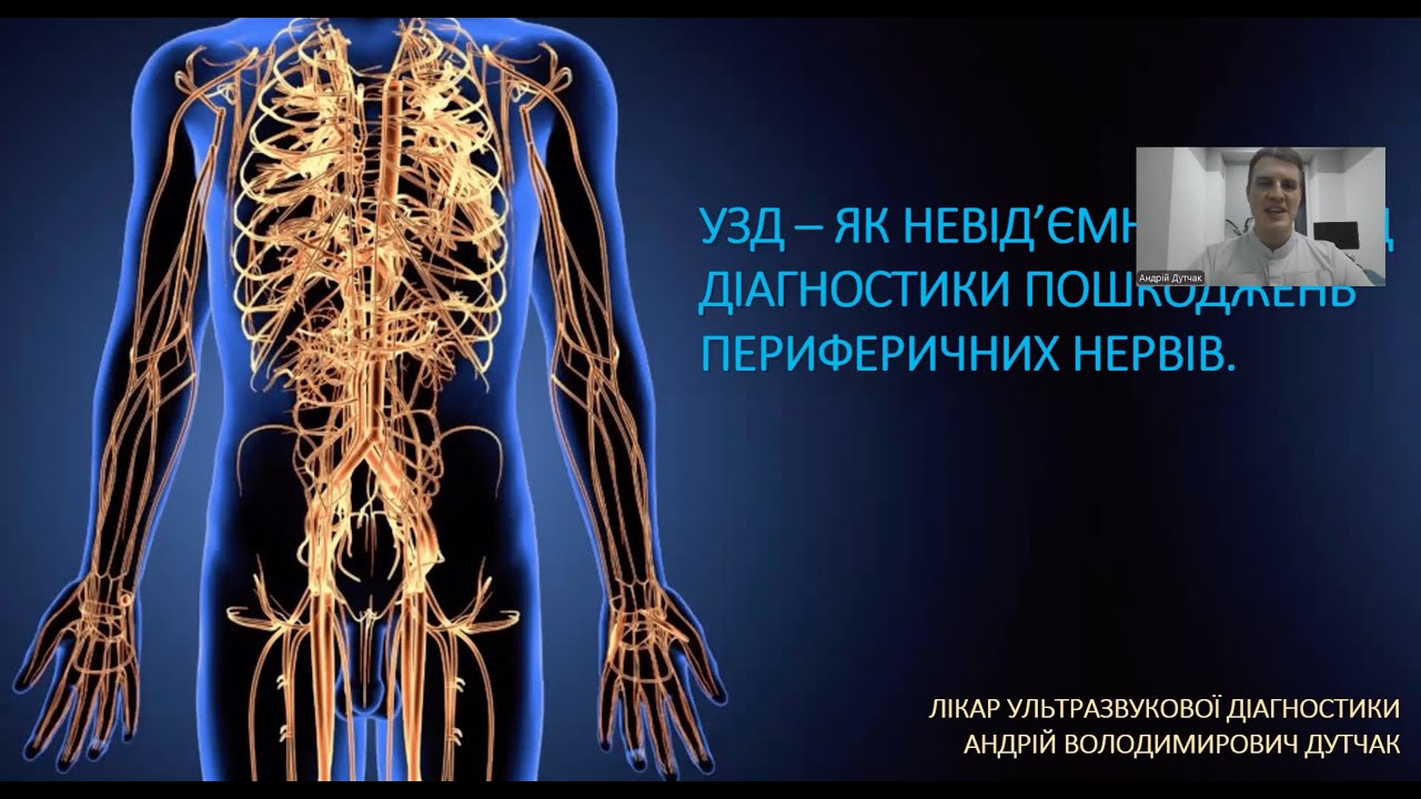 Cetus 40 Focus & Fusion | УЗД периферичних нервів і плечового суглоба | Спікер —Андрій Дутчак