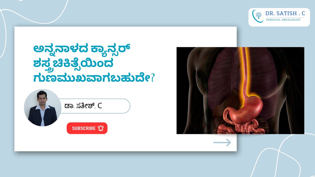 ಅನ್ನನಾಳದ ಕ್ಯಾನ್ಸರ್ |  esophageal cancer surgery | Dr. Sathish. C | Surgical Oncologist