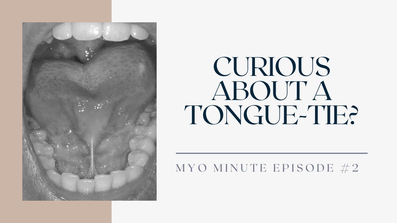Myo Minute Episode #2: Curious About a Tongue-Tie? #tonguetie #tonguetied