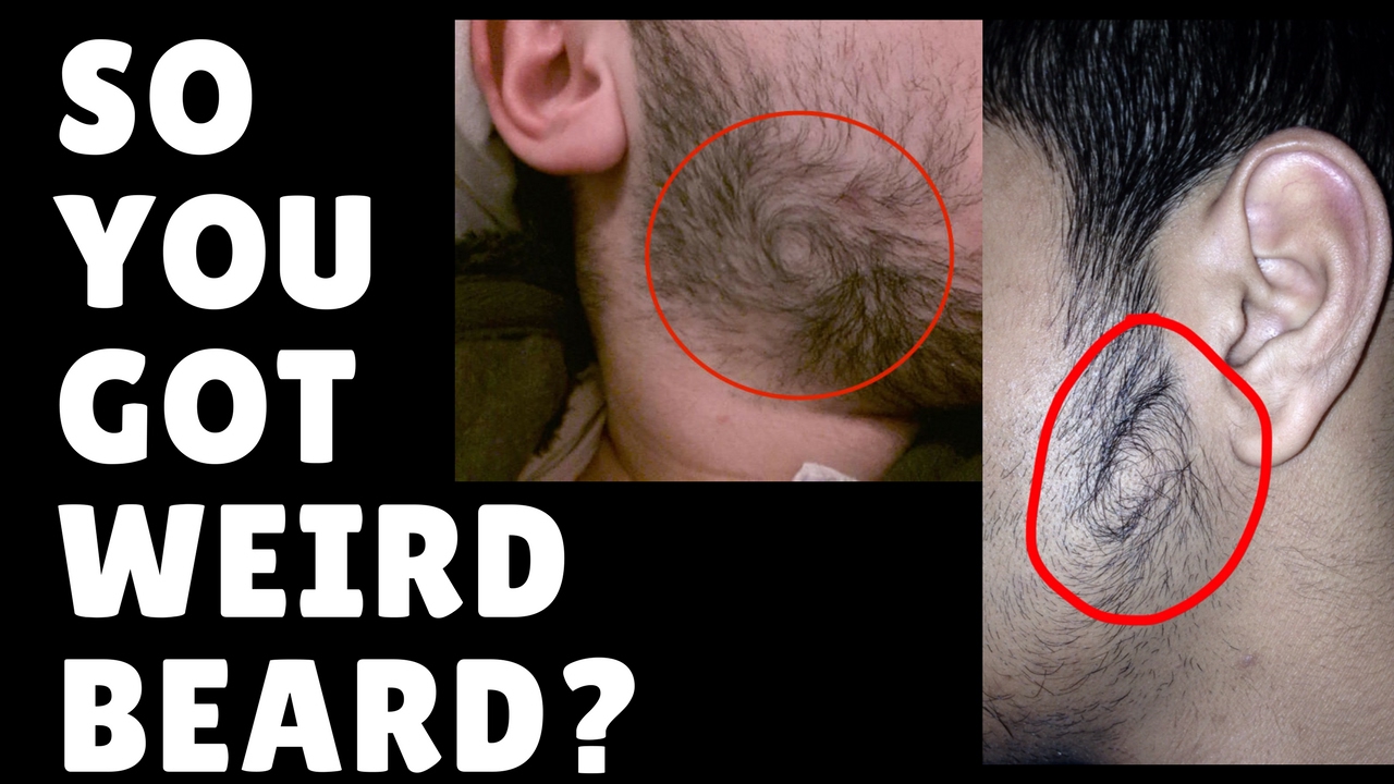 Week #5 - GOT WEIRD GROWTH PATTERNS?