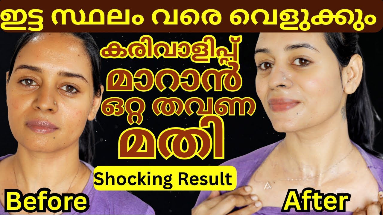അമ്പോ!! കരിവാളിപ്പ് ഒഴുകി പോകുന്നത് Live ആയി കാണാം 😱 Best Tan Removel Method at Home #suntan