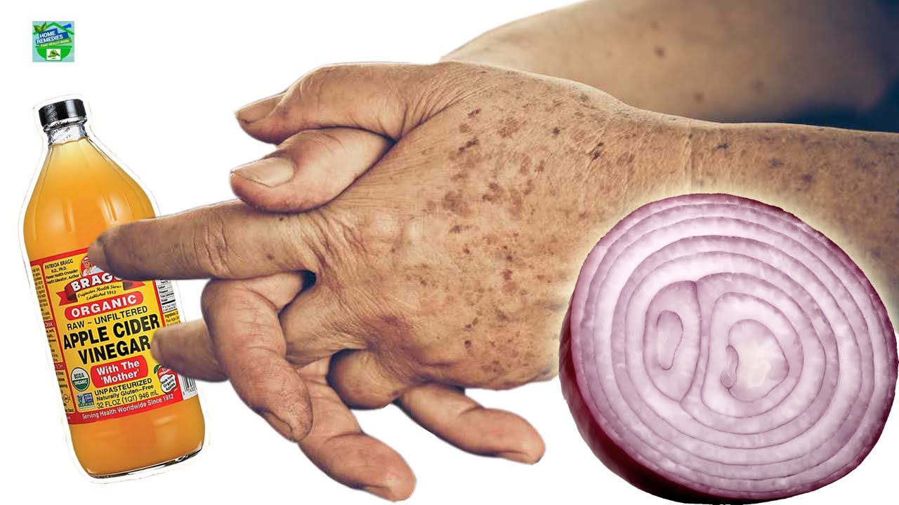 У вас есть пигментные пятна на коже? Удалите их с помощью этого простого ингредиента