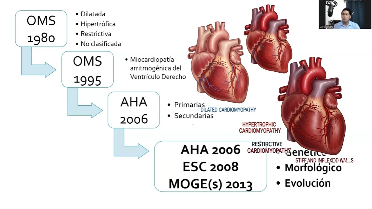 Cardiomiopatias | MIOcardiopatias