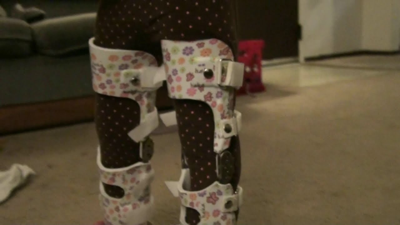 Putting On My Daughters New Leg Braces (and walking update!)