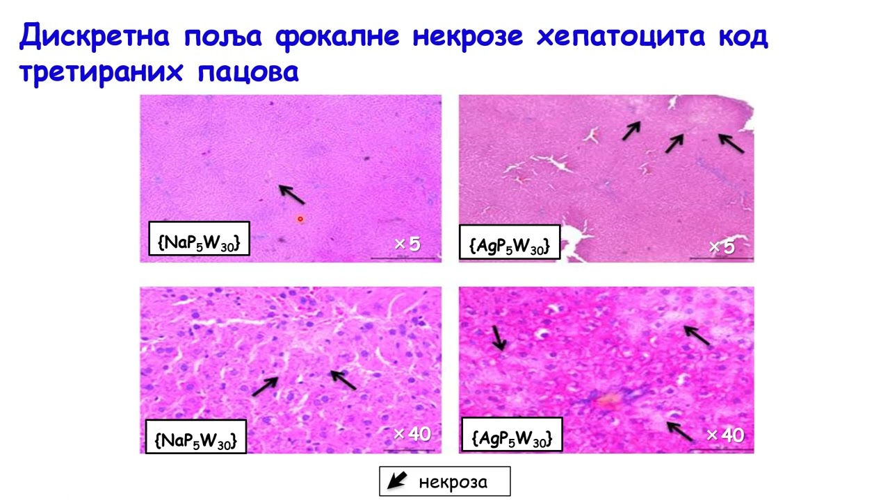 Doktorat - Marko Dinčić - Heteropolivolframati kao mogući antidijabetici: uticaj na hiperglikemiju..
