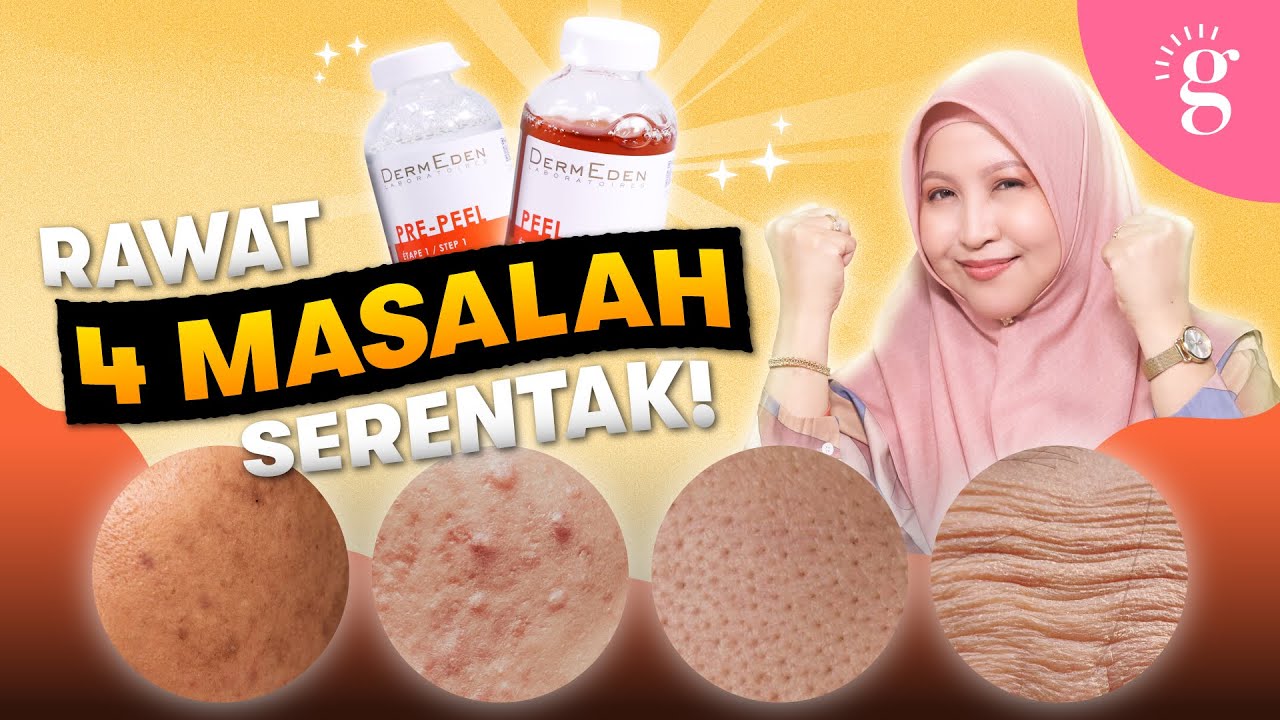 Cara Atasi Dark Spots, Pori Besar, Jerawat & Garis Halus Dengan Satu Produk
