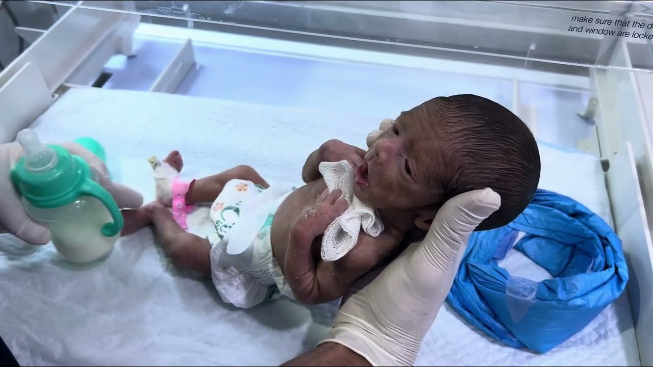 28 Week Premature Baby Condition Improved Feeding Well  NICU Progress Update 👶