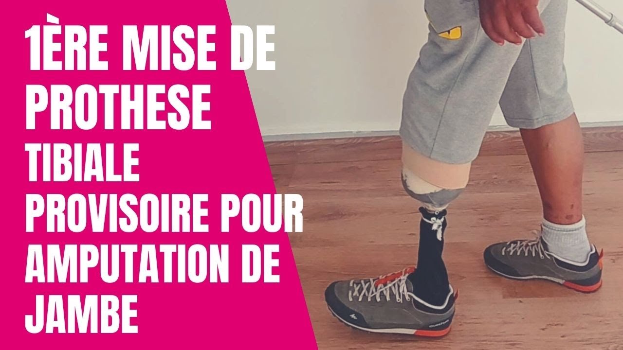 PROTHESE TIBIALE PROVISOIRE-DE REEDUCATION-1/2