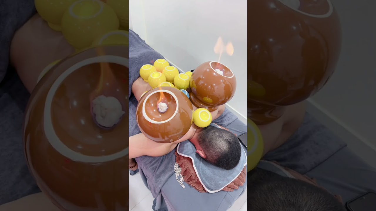 [ASMR] Chinese Cupping Therapy with Double Big Cup #asmr #youtubeshorts #cupping #video #massage